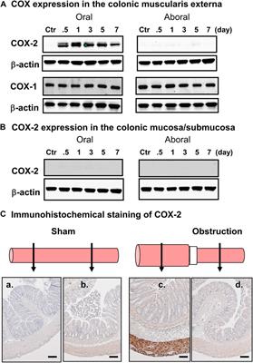 Targeting Mechano-Transcription Process as Therapeutic Intervention in Gastrointestinal Disorders